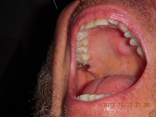 my new gold molar