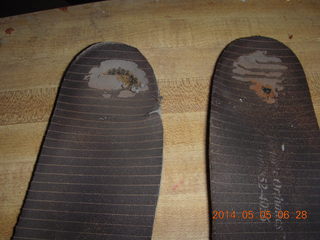 my orthotics - maybe why I had heel blisters
