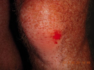 3 8ql. my scraped up knee