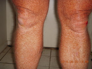 4 8ql. my scraped up knee