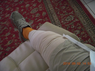 8 9f2. after knee operation