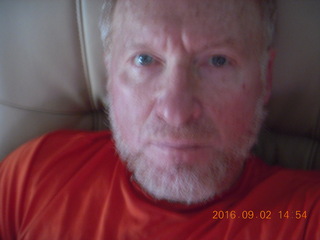 11 9f2. after knee operation + Adam