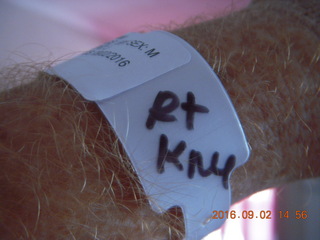 13 9f2. after knee operation