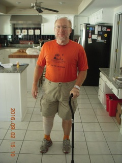 18 9f2. after knee operation + Adam walking with cane