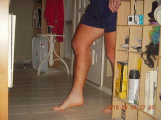 30 9f3. two days after my knee surgery