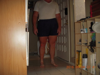 38 9f3. two days after my knee surgery
