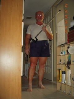 41 9f3. two days after my knee surgery
