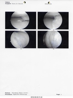 43 9f5. knee surgery images