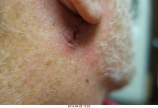 BREO Ellipta anti-asthma inhaler box