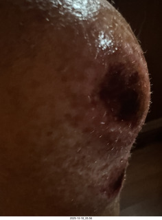 Philadelphia - The Franklin Institute  - knee