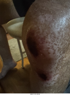 Philadelphia - The Franklin Institute  - knee