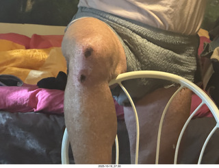 my knee mri report in small type